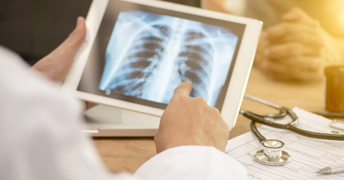 tubercolosi,-dall’ue-185-milioni-per-la-ricerca-sui-farmaci