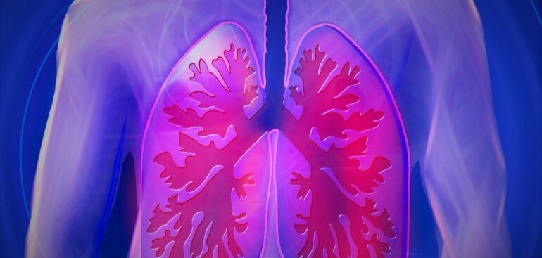 reumatologia,-specialisti-e-pazienti:-«troppe-differenze-territoriali-per-le-interstiziopatie-polmonari»