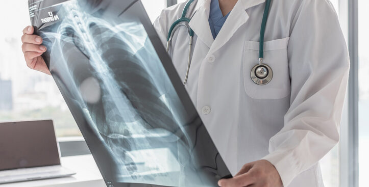 tsrm,-galdieri:-«tecnici-di-radiologia-siano-inseriti-nelle-equipe-delle-case-di-comunita»