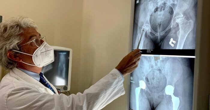 raro-intervento-protesi-all’anca-su-14enne-dopo-la-leucemia