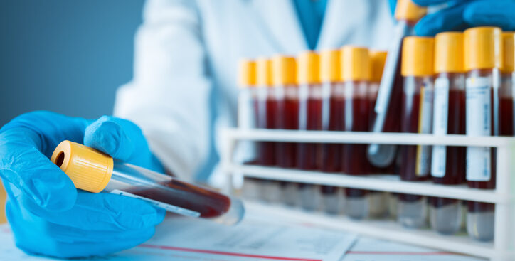 famiglie-sma:-«grazie-a-test-genetico-universale,-la-diagnosi-non-e-piu-una-condanna-ma-un-salvavita»