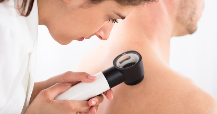 sale-di-5-anni-sopravvivenza-per-melanoma