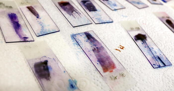 in-pensione-il-vetrino-del-microscopio,-diventa-digitale