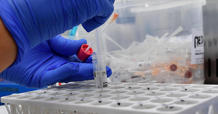 bando-per-7-progetti-anti-sla,-dalla-cura-genica-alla-diagnosi