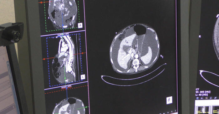 oncologi,-verso-ondata-di-casi-avanzati-per-ritardi-da-pandemia