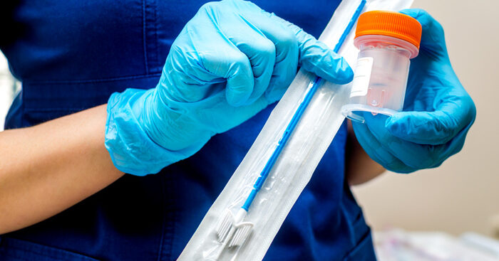 tumori:-a-int-piattaforma-per-processare-campioni-pap-test