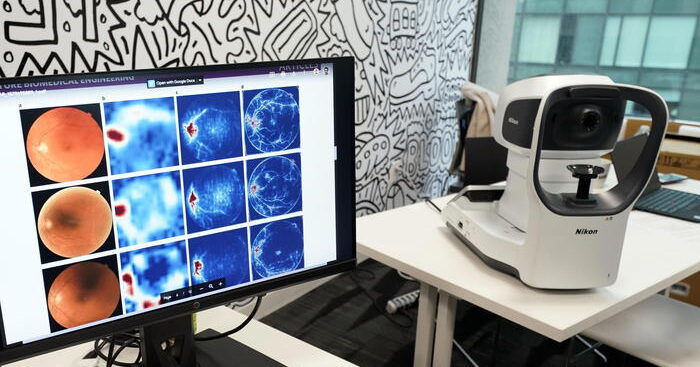 in-italia-rischio-glaucoma-per-1,2-milioni,-solo-meta-lo-sa