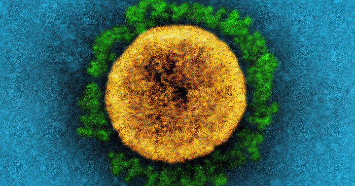 long-covid,-con-le-varianti-del-virus-sintomi-diversi