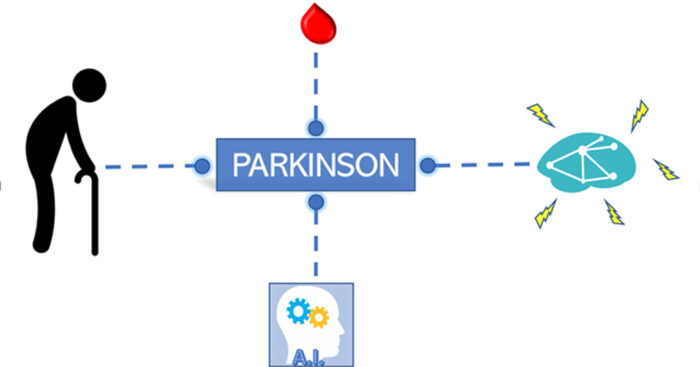 salute:-uniba,-diagnosi-precoce-parkinson-con-analisi-sangue