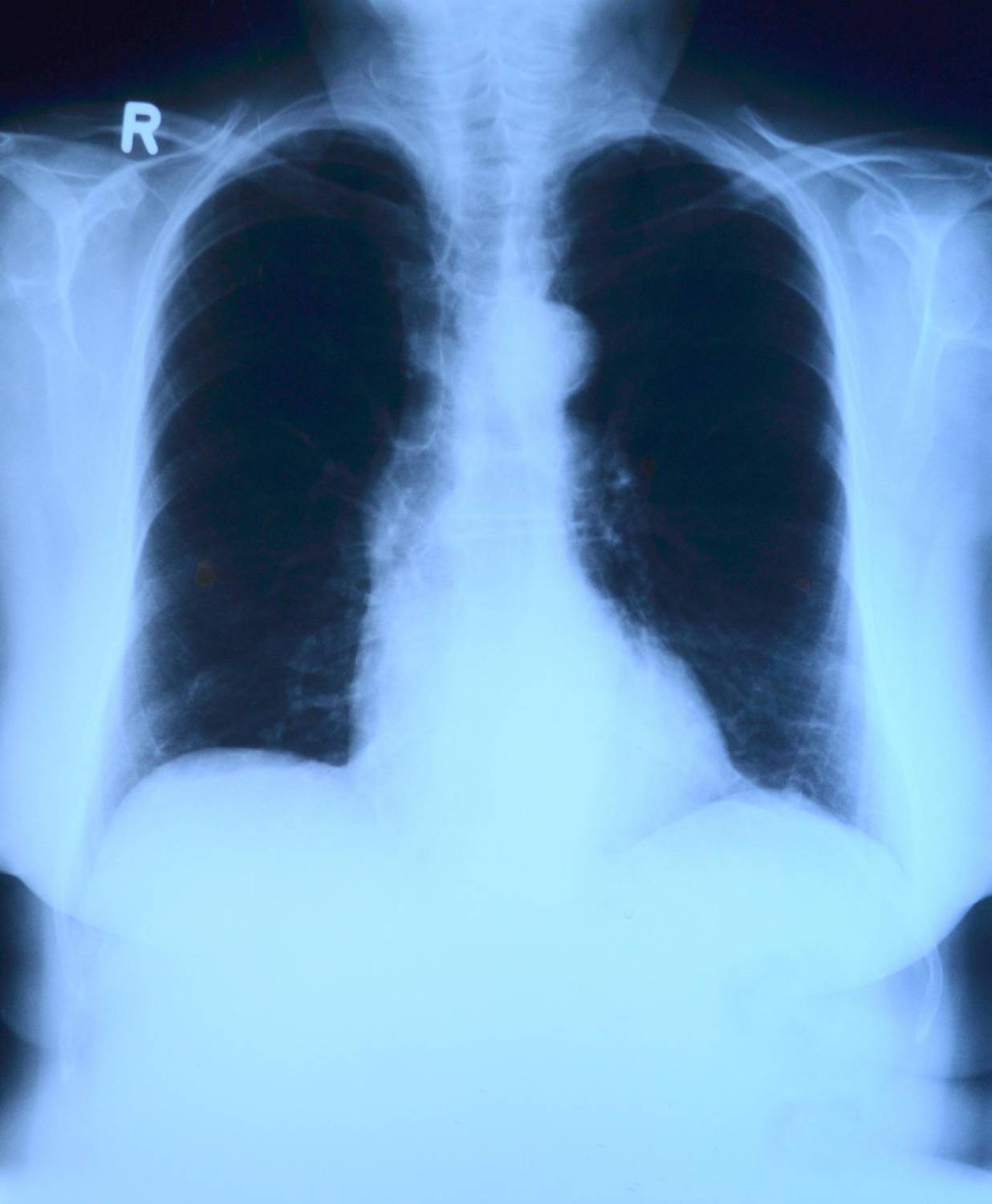 colpa-grave-la-lettura-sbagliata-di-una-radiografia
