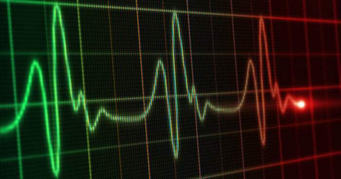 con-la-pillola-‘tre-in-una’-meno-30%-rischio-infarto-e-ictus