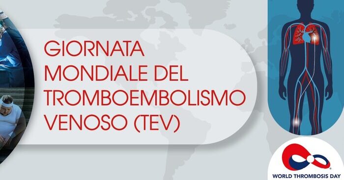 pazienti-ricoverati-a-rischio-trombosi,consigli-per-evitarla