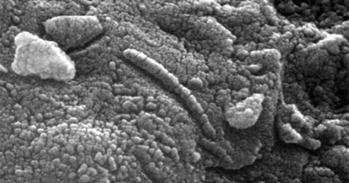 da-batteri-killer-oltre-500mila-morti-in-europa-nel-2019