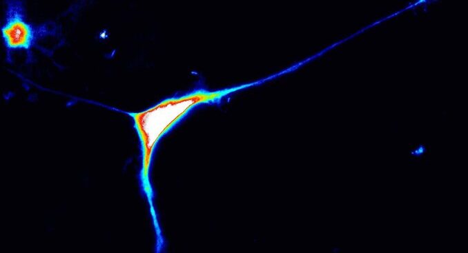 scoperto-un-nuovo-gene-responsabile-dell’autismo