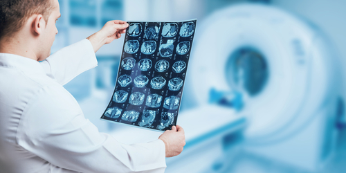 la-lotta-ai-tumori-deve-superare-anche-poverta-e-burocrazia