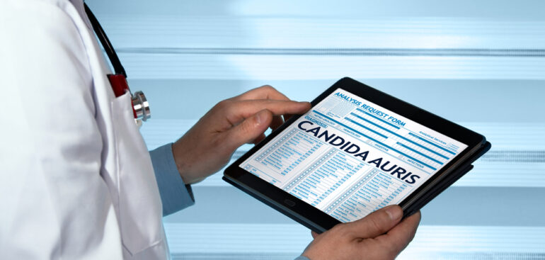 candida-auris:-massima-attenzione-negli-ospedali