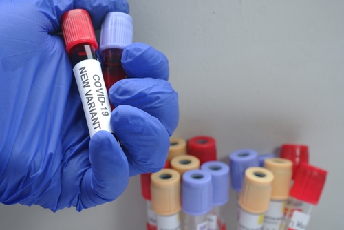 covid:-nuova-variante-sotto-monitoraggio.-oms:-kraken-in-calo