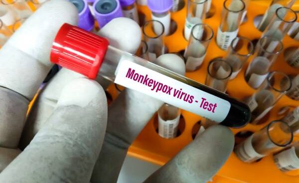 mpox,-oms-domani-pronto-a-dichiarare-fine-dell’emergenza-sanitaria?