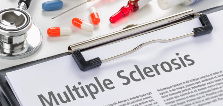 sclerosi-multipla,-svelato-il-mistero-della-«parentela»-con-il-virus-della-mononucleosi