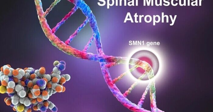 a-singapore-raccolti-2-milioni-per-bimbo-con-malattia-rara