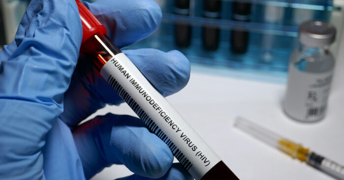 hiv,-in-usa-calano-le-infezioni,-12%-in-4-anni