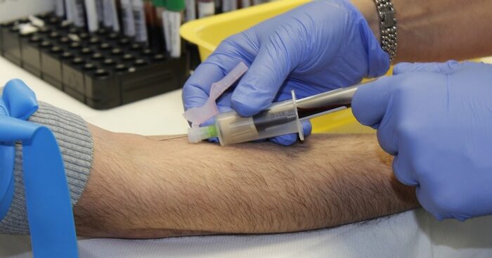 covid,-e-stata-dimostrata-la-preferenza-del-virus-per-il-gruppo-sanguigno-a