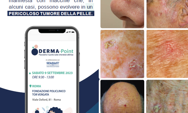 al-via-la-campagna-“derma-point,-facciamo-il-punto-sulla-cheratosi-attinica”