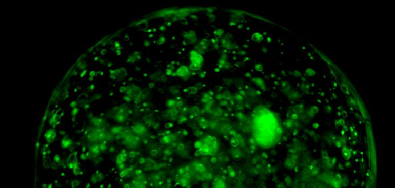 cancro:-si-combatte-con-uno-“tsunami”-di-luce