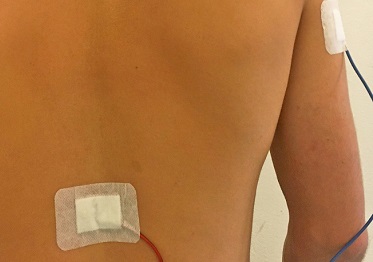 midollo-osseo,-sempre-piu-giovani-disposti-a-donare