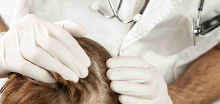 giornata-alopecia-areata:-pazienti,-clinici-e-istituzioni-uniti-per-migliorare-la-qualita-della-vita