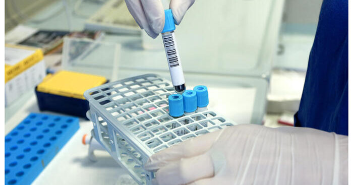 diagnosi-prenatale,-lo-studio-dell’esoma-contro-le-malattie-genetiche