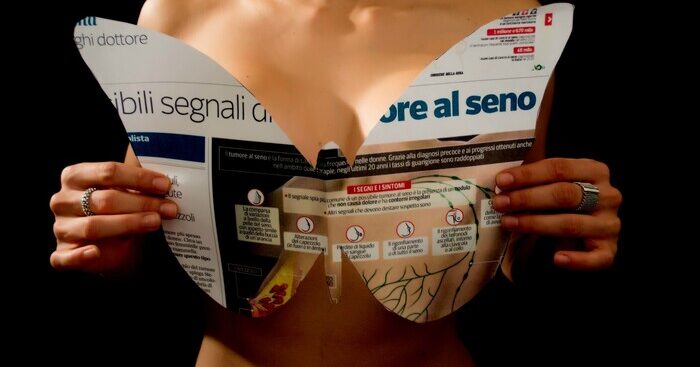 la-ricostruzione-del-seno-dopo-un-tumore,-il-ssn-la-prevede-solo-in-differita