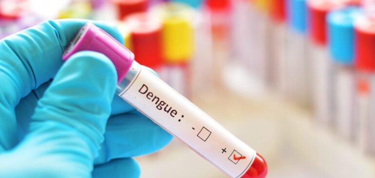 dengue,-dal-ministero-le-“misure-anti-zanzara-in-eventi-sportivi-e-zone-umide”