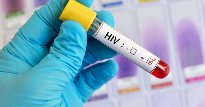 giornata-mondiale-dell’aids-,-dopo-la-pandemia-tornano-a-salire-i-casi-di-hiv