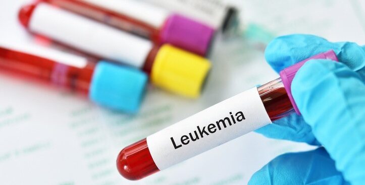 oncoematologia:-aifa-estende-indicazione-di-zanubrutinib