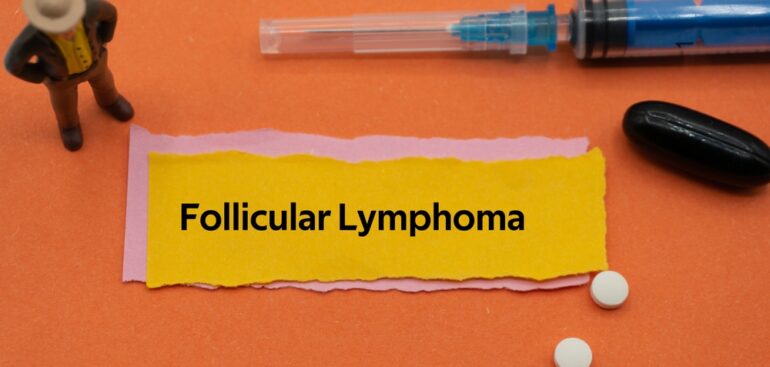 linfoma-follicolare,-studio-italiano-“promuove”-combo-di-due-immunoterapici