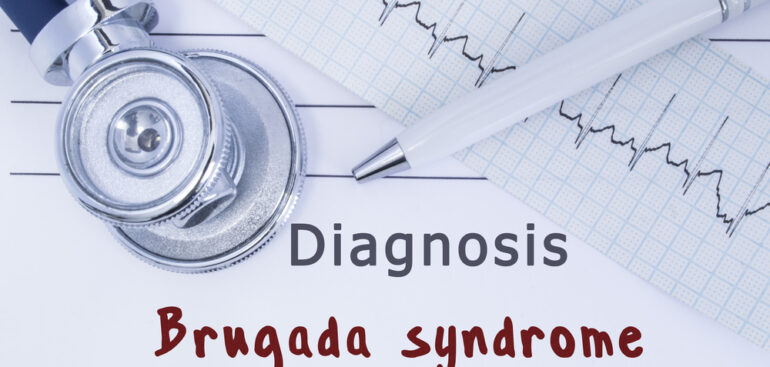 sindrome-di-brugada,-cura-italiana-‘libera’-dal-rischio-di-morte-improvvisa