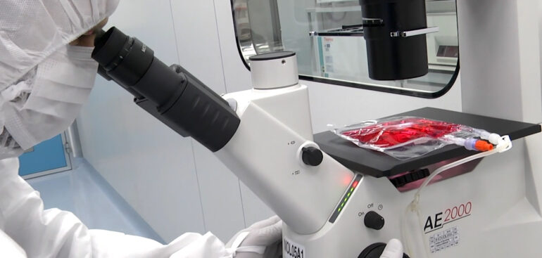 tumori:-studio-italiano-allarga-utilizzo-delle-car-t-nel-glioblastoma