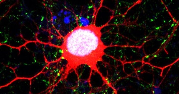 potenziale-efficacia-di-una-terapia-immunologica-con-car-t-sul-glioblastoma
