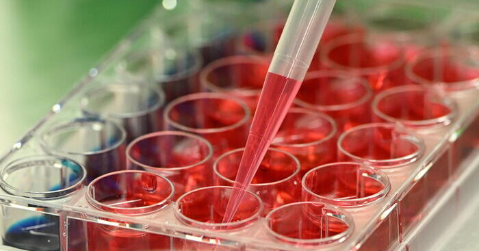 tumore-del-rene,-immunoterapia-aumenta-l’aspettativa-di-vita