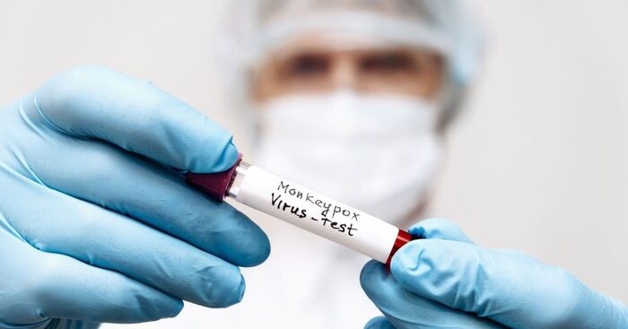 comitato-ue,-in-europa-non-c’e-emergenza-sanitaria-su-mpox