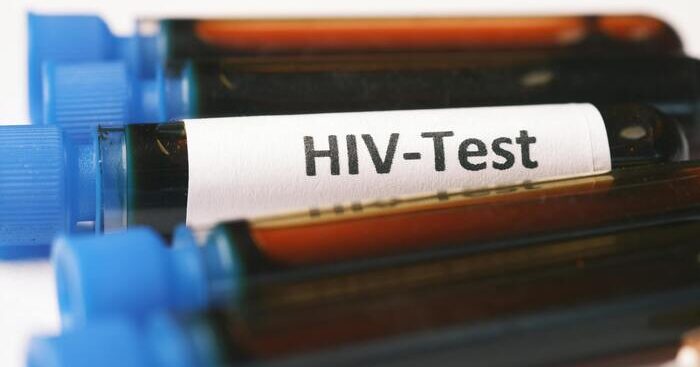 testing-week,-iss-aggiorna-mappa-per-test-hiv,epatiti-e-sifilide