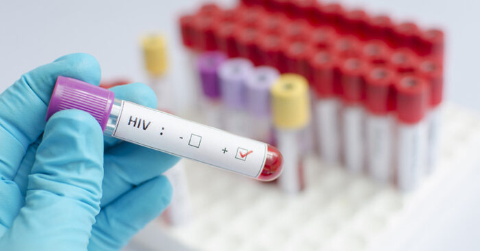 hiv,-crescono-le-nuove-diagnosi-in-italia