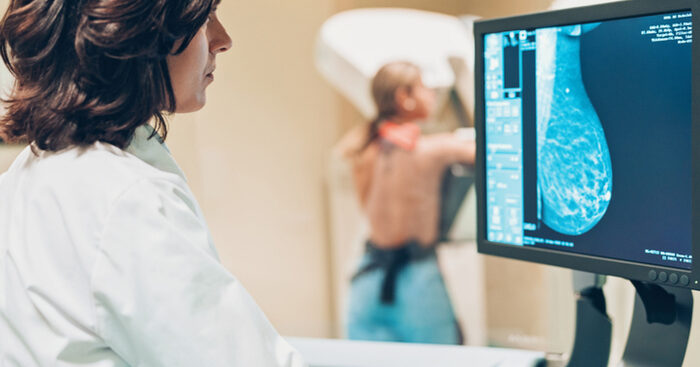 screening-oncologico-rallenta-ma-conferma-la-ripresa-dopo-covid