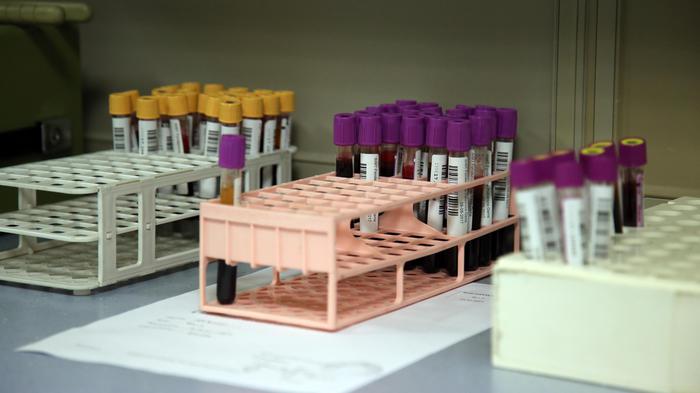 anemia-mediterranea-legata-a-invecchiamento-precoce-cervello