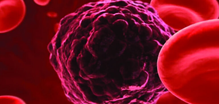 la-doppia-biopsia,-liquida-e-su-tessuto,-migliora-la-sopravvivenza