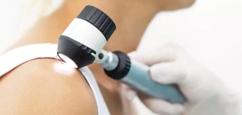 melanoma-day,-una-giornata-nazionale-per-la-prevenzione