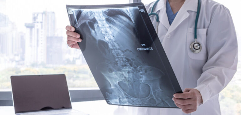 tumore-stomaco,-meno-del-20%-dei-casi-e-individuato-in-fase-iniziale