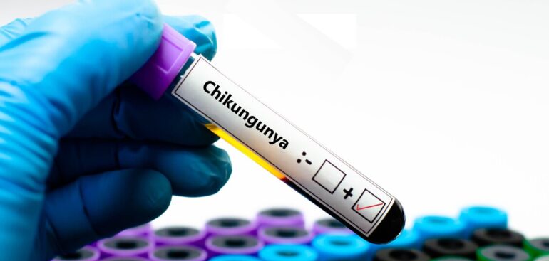 chikungunya,-in-italia-negli-anni-centinaia-di-casi-autoctoni