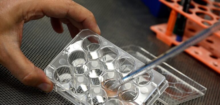 passo-avanti-nella-diagnosi-della-sla,-studio-fra-torino-e-usa